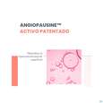 Avene Antirougeurs Rosamed Konzentrat 30ml, A-Nr.: 5862025 - 15