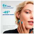 Sie sehen eine Packung Ducray Keracnyl Pp+ Creme Gegen Hautunreinheiten 30ml, Produktbild: 19 Ducray Keracnyl Pp+ Creme Gegen Hautunreinheiten 30ml, A-Nr.: 5564397 - 19